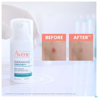 Sie sehen eine Packung Avene Cleanance Comedomed Gel-cre Konzentrat 30ml, Produktbild: 04 Avene Cleanance Comedomed Gel-cre Konzentrat 30ml, A-Nr.: 5228334 - 04